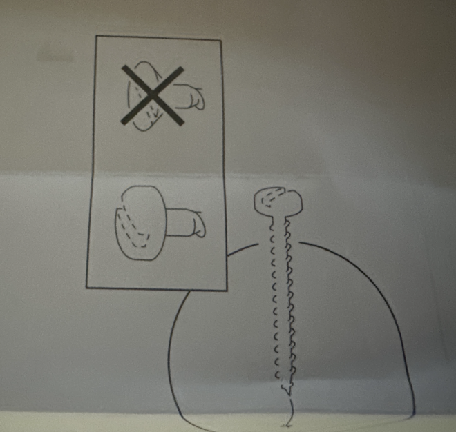 Ramshult top screw